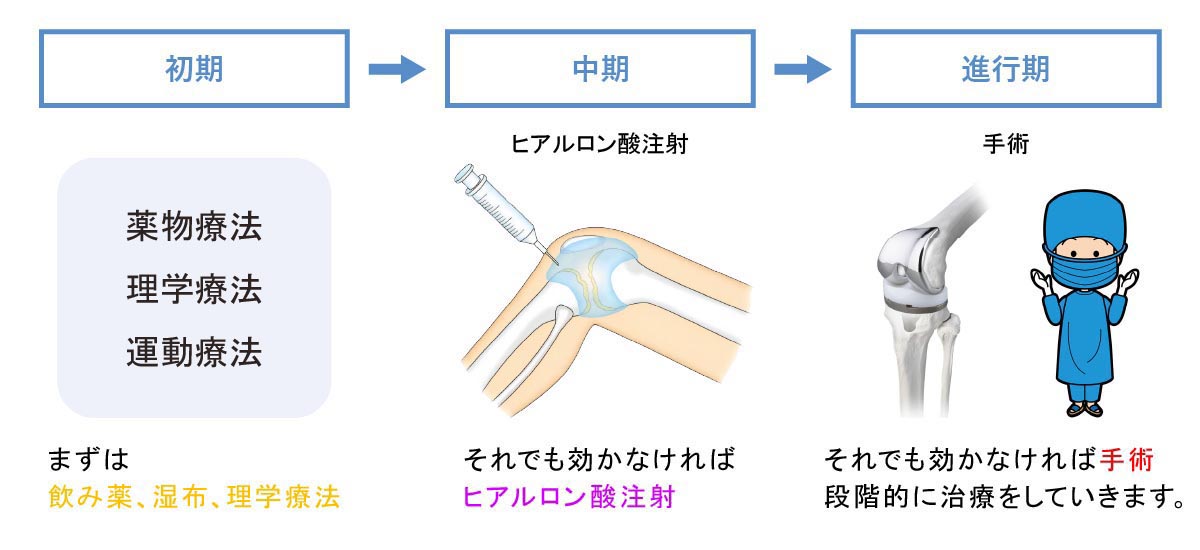 従来の変形性膝関節症の治療